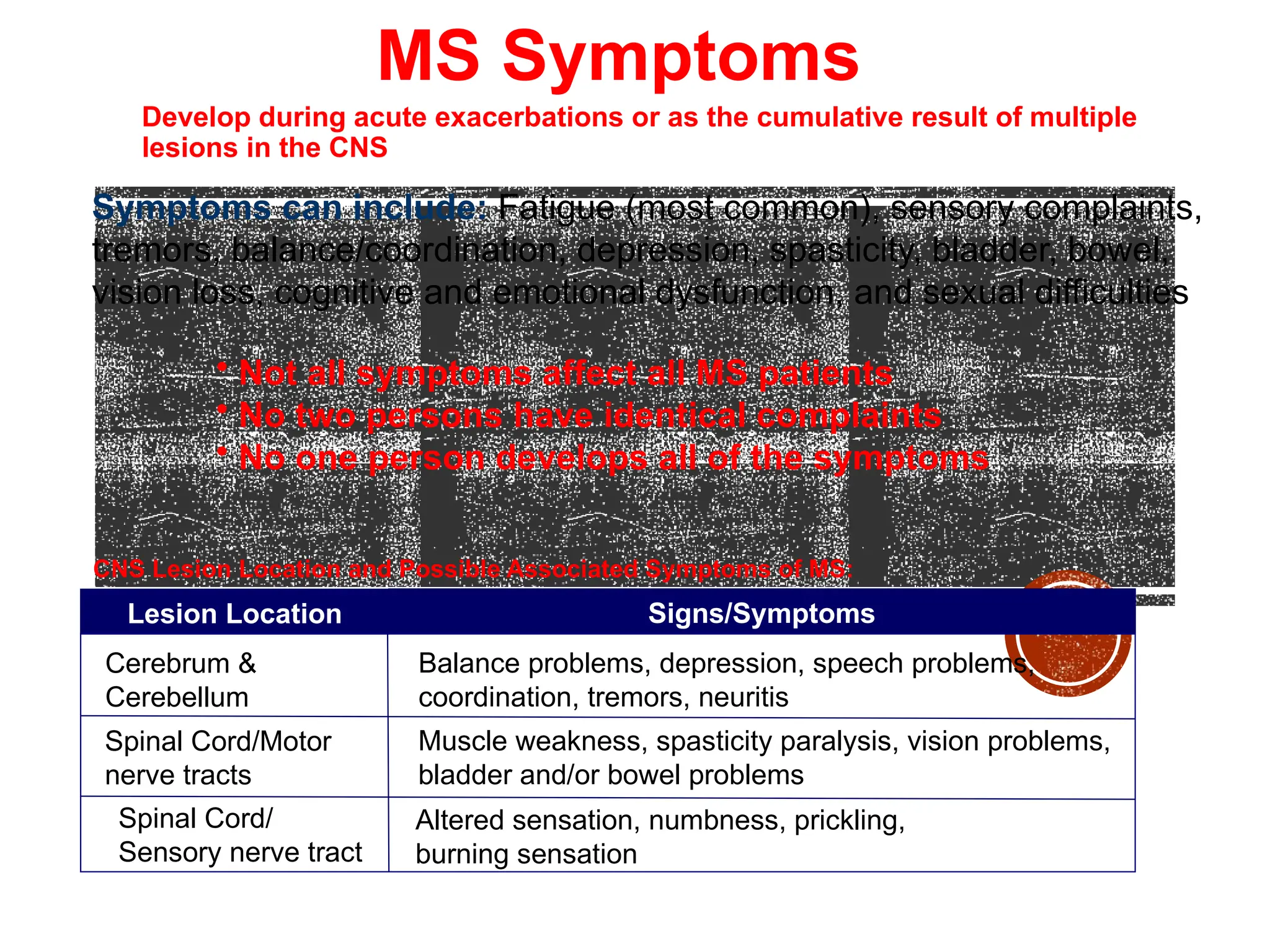 MS Symptoms
Develop during acute exacerbations or as the cumulative result of multiple
lesions in the CNS
Cerebrum &
Cerebellum
Lesion Location
• Not all symptoms affect all MS patients
• No two persons have identical complaints
• No one person develops all of the symptoms
Signs/Symptoms
Balance problems, depression, speech problems,
coordination, tremors, neuritis
Spinal Cord/Motor
nerve tracts
Muscle weakness, spasticity paralysis, vision problems,
bladder and/or bowel problems
Spinal Cord/
Sensory nerve tract
Altered sensation, numbness, prickling,
burning sensation
Symptoms can include: Fatigue (most common), sensory complaints,
tremors, balance/coordination, depression, spasticity, bladder, bowel,
vision loss, cognitive and emotional dysfunction, and sexual difficulties
CNS Lesion Location and Possible Associated Symptoms of MS:
 