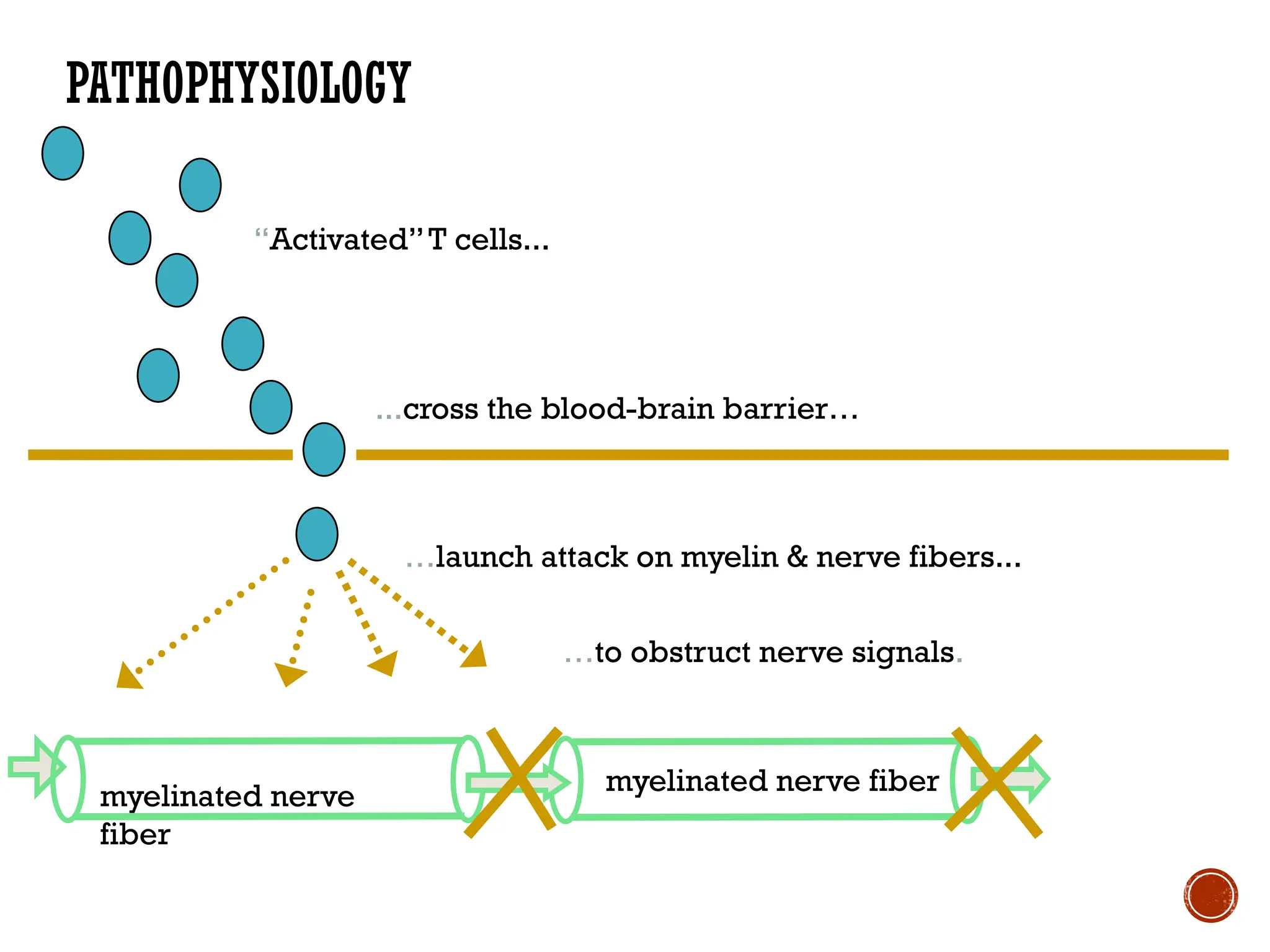 PATHOPHYSIOLOGY
...cross the blood-brain barrier…
…launch attack on myelin & nerve fibers...
“Activated”T cells...
…to obstruct nerve signals.
myelinated nerve
fiber
myelinated nerve fiber
 