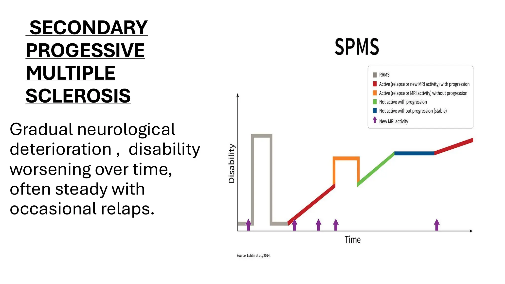 SECONDARY
PROGESSIVE
MULTIPLE
SCLEROSIS
Gradual neurological
deterioration , disability
worsening over time,
often steady with
occasional relaps.
 