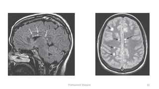 Prathamesh Shasane 16
 