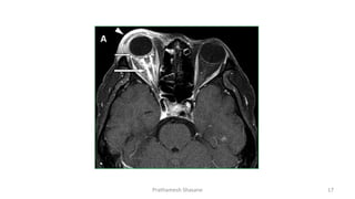 Prathamesh Shasane 17
 