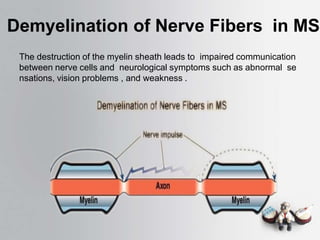 Demyelination of Nerve Fibers in MS
The destruction of the myelin sheath leads to impaired communication
between nerve cells and neurological symptoms such as abnormal se
nsations, vision problems , and weakness .
 