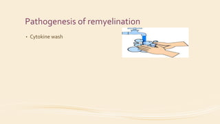 Pathogenesis of remyelination
• Cytokine wash
 