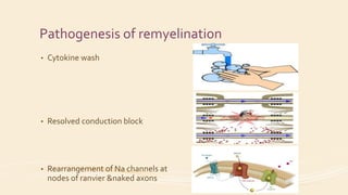 Pathogenesis of remyelination
• Cytokine wash
• Resolved conduction block
• Rearrangement of Na channels at
nodes of ranvier &naked axons
 