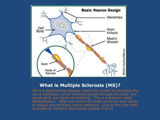 What is Multiple Sclerosis (MS)?MS is a autoimmune disease where the myelin surrounding the nerve pathways, which transmit signals through the brain and spinal cord, are slowly diminishing.  This is a process called demyelization.  After this occurs the body produces scar tissue or plaque around these nerve pathways.  Due to this, the body is unable to transmit information quickly if at all.  