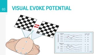 VISUAL EVOKE POTENTIAL
60
 