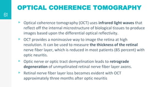 OPTICAL COHERENCE TOMOGRAPHY
▹ Optical coherence tomography (OCT) uses infrared light waves that
reflect off the internal microstructure of biological tissues to produce
images based upon the differential optical reflectivity.
▹ OCT provides a noninvasive way to image the retina at high
resolution. It can be used to measure the thickness of the retinal
nerve fiber layer, which is reduced in most patients (85 percent) with
optic neuritis.
▹ Optic nerve or optic tract demyelination leads to retrograde
degeneration of unmyelinated retinal nerve fiber layer axons.
▹ Retinal nerve fiber layer loss becomes evident with OCT
approximately three months after optic neuritis
61
 