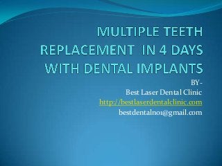 BY-
Best Laser Dental Clinic
http://bestlaserdentalclinic.com
bestdentalno1@gmail.com
 