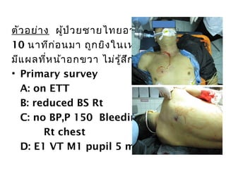 ตัวอย่ำง ผู้ป่วยชำยไทยอำยุ 40 ปี
10 นำทีก่อนมำ ถูกยิงในเหตุกำรณ์ชุมนุม
มีแผลที่หน้ำอกขวำ ไม่รู้สึกตัว มูลนิธินำำส่ง
• Primary survey
A: on ETT
B: reduced BS Rt
C: no BP,P 150 Bleeding from GSW
Rt chest
D: E1 VT M1 pupil 5 mm fixed BE
 