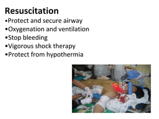 Resuscitation
•Protect and secure airway
•Oxygenation and ventilation
•Stop bleeding
•Vigorous shock therapy
•Protect from hypothermia
 
