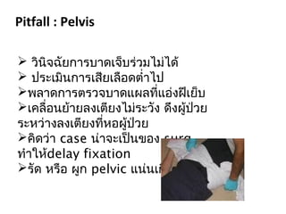  วินิจฉัยการบาดเจ็บร่วมไม่ได้
 ประเมินการเสียเลือดตำ่าไป
พลาดการตรวจบาดแผลที่แอ่งฝีเย็บ
เคลื่อนย้ายลงเตียงไม่ระวัง ดึงผู้ป่วย
ระหว่างลงเตียงที่หอผู้ป่วย
คิดว่า case น่าจะเป็นของ surg.
ทำาให้delay fixation
รัด หรือ ผูก pelvic แน่นเกินไป
Pitfall : Pelvis
 