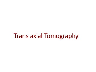 Trans axial Tomography
 