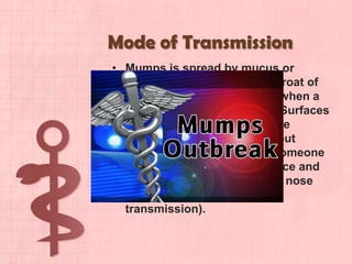 Mumps | PPTX