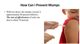 Mumps | PPTX