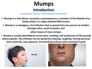 Mumps
Introduction
prepared by Gaurab Pandey Health professional
 Mumps is a viral illness caused by a paramyxovirus a member of the Rubella virus
family which is a single standard RNA viruses
 Mumps is a contagious viral infection that is spread from one person to another
through saliva, nasal secretion, and
other means of close contact.
 Mumps is usually identified by severe pain, swelling, and tenderness of the parotid
salivary glands. The infection can be spread by sneezing, coughing, sharing personal
items (utensils, cups, glasses), and touching surfaces with unwashed hands
 