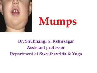 Mumps
Dr. Shubhangi S. Kshirsagar
Assistant professor
Department of Swasthavritta & Yoga
 