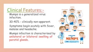 Mumps.pptx