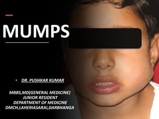 MUMPS
• DR. PUSHKAR KUMAR
MBBS,MD(GENERAL MEDICINE)
JUNIOR RESIDENT
DEPARTMENT OF MEDICINE
DMCH,LAHERIASARAI,DARBHANGA
 