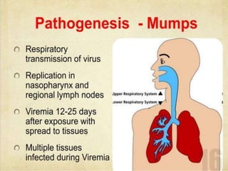Mumps.pptx