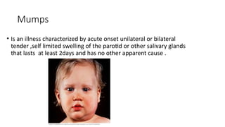 Comprehensive Overview of Mumps: Etiology, Pathogenesis, and Management ...