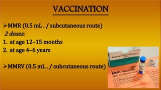 Mumps | PPTX
