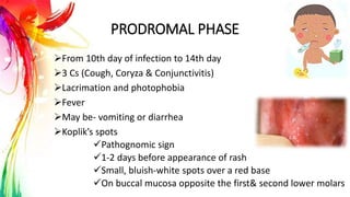 PRODROMAL PHASE
From 10th day of infection to 14th day
3 Cs (Cough, Coryza & Conjunctivitis)
Lacrimation and photophobia
Fever
May be- vomiting or diarrhea
Koplik’s spots
Pathognomic sign
1-2 days before appearance of rash
Small, bluish-white spots over a red base
On buccal mucosa opposite the first& second lower molars
 