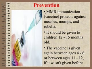 Prevention MMR immunization (vaccine) protects against measles, mumps, and rubella.  It should be given to children 12 - 15 months old.  The vaccine is given again between ages 4 - 6, or between ages 11 - 12, if it wasn't given before. 