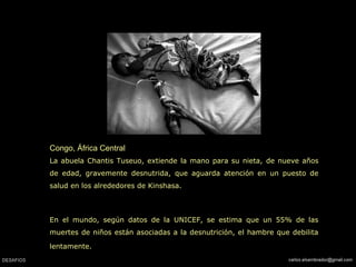 Congo, África Central
La abuela Chantis Tuseuo, extiende la mano para su nieta, de nueve años
de edad, gravemente desnutrida, que aguarda atención en un puesto de
salud en los alrededores de Kinshasa.
En el mundo, según datos de la UNICEF, se estima que un 55% de las
muertes de niños están asociadas a la desnutrición, el hambre que debilita
lentamente.
 
