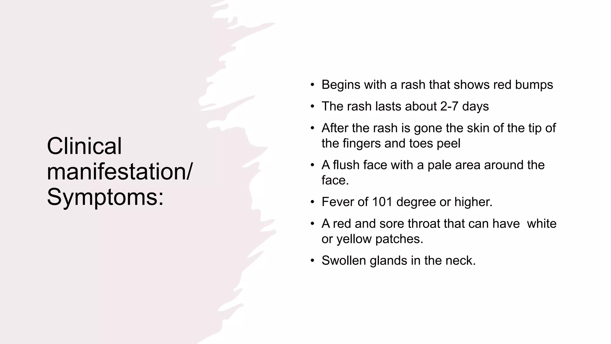 Scarlet fever Presentation.pptx