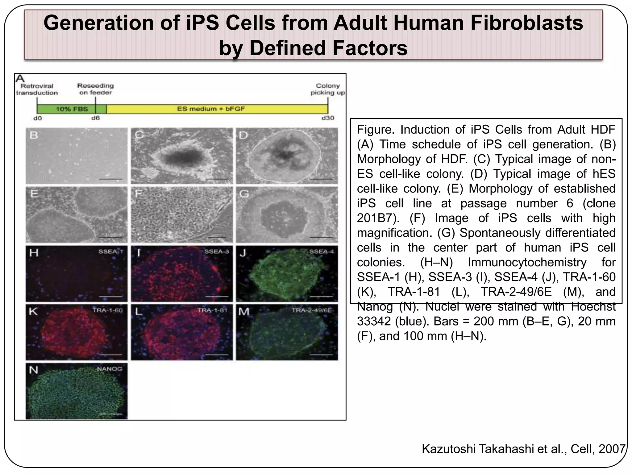Generation of iPS Cells from Adult Human Fibroblasts
by Defined Factors

Figure. Induction of iPS Cells from Adult HDF
(A) Time schedule of iPS cell generation. (B)
Morphology of HDF. (C) Typical image of nonES cell-like colony. (D) Typical image of hES
cell-like colony. (E) Morphology of established
iPS cell line at passage number 6 (clone
201B7). (F) Image of iPS cells with high
magnification. (G) Spontaneously differentiated
cells in the center part of human iPS cell
colonies. (H–N) Immunocytochemistry for
SSEA-1 (H), SSEA-3 (I), SSEA-4 (J), TRA-1-60
(K), TRA-1-81 (L), TRA-2-49/6E (M), and
Nanog (N). Nuclei were stained with Hoechst
33342 (blue). Bars = 200 mm (B–E, G), 20 mm
(F), and 100 mm (H–N).

Kazutoshi Takahashi et al., Cell, 2007

 