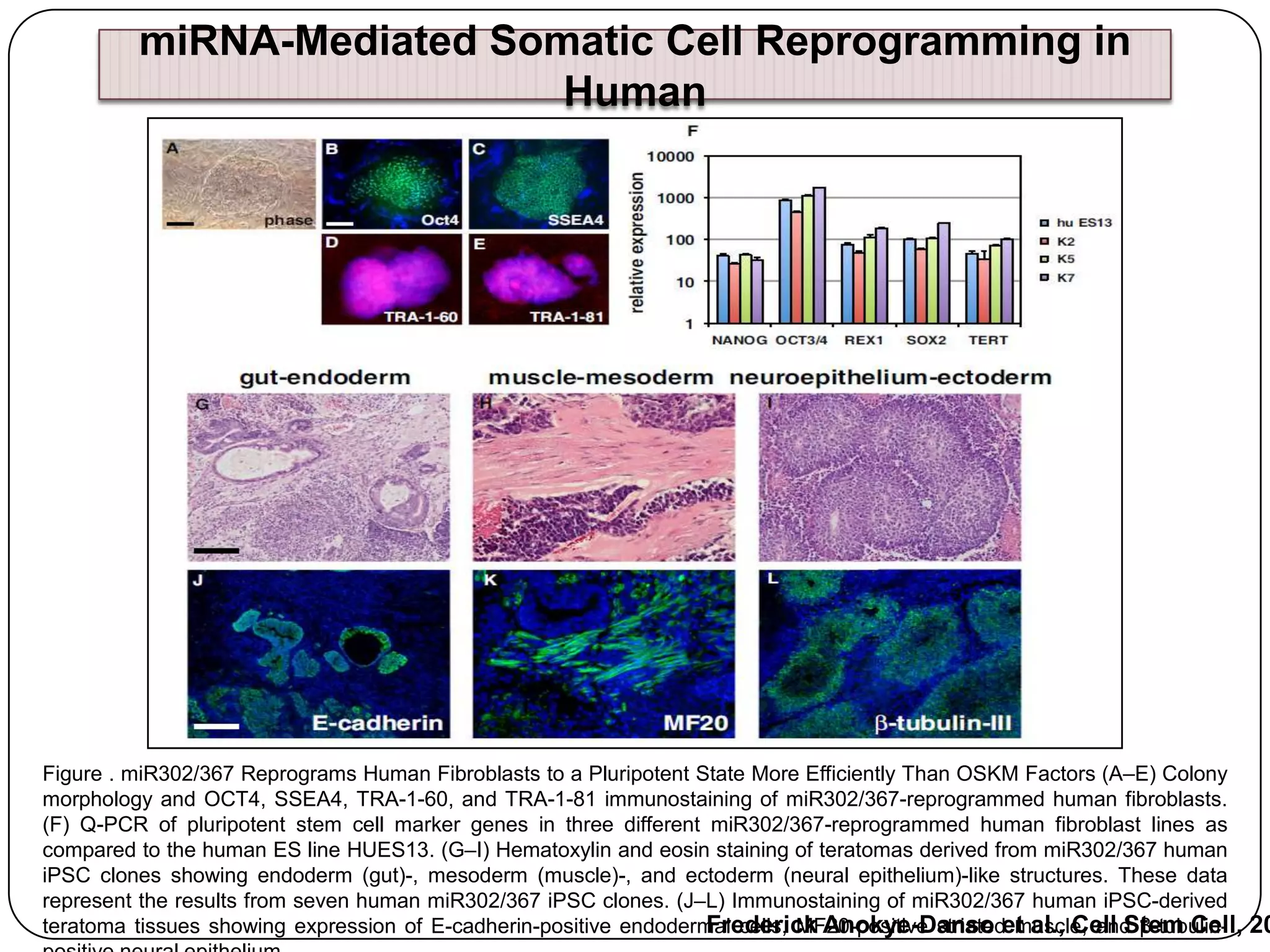 miRNA-Mediated Somatic Cell Reprogramming in
Human

Figure . miR302/367 Reprograms Human Fibroblasts to a Pluripotent State More Efficiently Than OSKM Factors (A–E) Colony
morphology and OCT4, SSEA4, TRA-1-60, and TRA-1-81 immunostaining of miR302/367-reprogrammed human fibroblasts.
(F) Q-PCR of pluripotent stem cell marker genes in three different miR302/367-reprogrammed human fibroblast lines as
compared to the human ES line HUES13. (G–I) Hematoxylin and eosin staining of teratomas derived from miR302/367 human
iPSC clones showing endoderm (gut)-, mesoderm (muscle)-, and ectoderm (neural epithelium)-like structures. These data
represent the results from seven human miR302/367 iPSC clones. (J–L) Immunostaining of miR302/367 human iPSC-derived
Frederick Anokye-Danso muscle, and β-tubulinteratoma tissues showing expression of E-cadherin-positive endodermal cells, MF20-positive striatedet al., Cell Stem Cell, 20

 