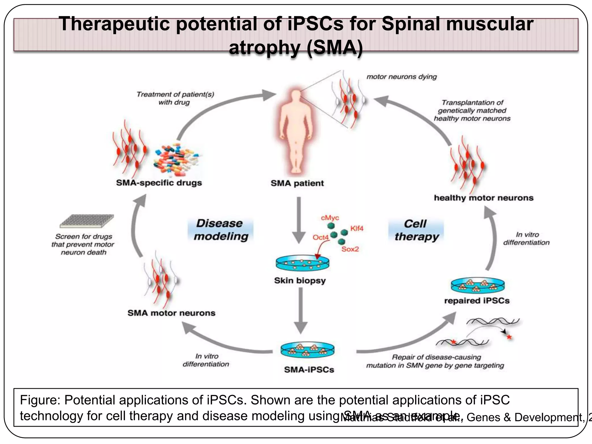 Therapeutic potential of iPSCs for Spinal muscular
atrophy (SMA)

Figure: Potential applications of iPSCs. Shown are the potential applications of iPSC
technology for cell therapy and disease modeling using Matthias Stadtfeld et al., Genes & Development, 2
SMA as an example.

 