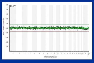 46,XY