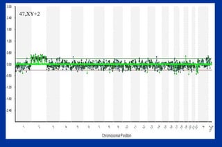 47,XY+2 
 