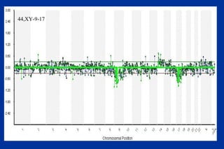 44,XY-9-17 
 