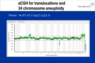 aaCCGGHH ffoorr ttrraannssllooccaattiioonnss aanndd 
2244 cchhrroommoossoommee aanneeuuppllooiiddyy 
Patient: 46,XY,t(3;11)(q22.2;q23.3) 
 