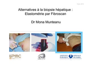 Alternatives à la biopsie hépatique :
     Elastométrie par Fibroscan

        Dr Mona Munteanu
 