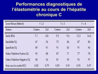 Performances diagnostiques de l’élastométrie au cours de l’hépatite chronique C 