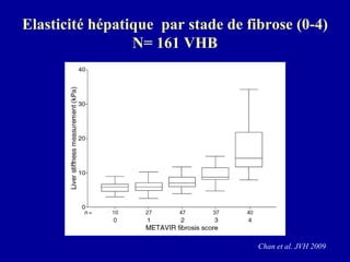 Elasticité hépatique  par stade de fibrose (0-4) N= 161 VHB Chan et al. JVH 2009 