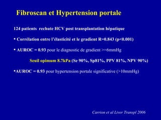 Fibroscan et Hypertension portale Carrion et al Liver Transpl 2006 124 patients  rechute HCV post transplantation hépatique Corrélation entre l’élasticité et le gradient R=0.843 (p<0.001)  AUROC = 0.93  pour le diagnostic de gradient >=6mmHg   Seuil opimum 8.7kPa  (Se 90%, Sp81%, PPV 81%, NPV 90%) AUROC = 0.93  pour hypertension portale significative (>10mmHg) 