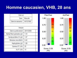 Homme caucasien, VHB, 28 ans 