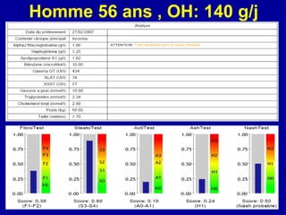 Homme 56 ans , OH: 140 g/j 