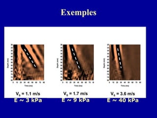 Exemples V S  = 1.1 m/s E ~ 3 kPa V S  = 1.7 m/s E ~ 9 kPa V S  = 3.6 m/s E ~ 40 kPa 