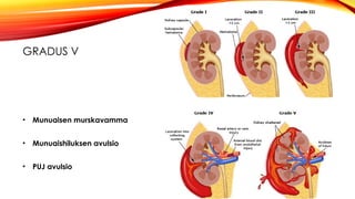 Comprehensive Overview of Kidney and Ureter Injuries: Diagnosis ...