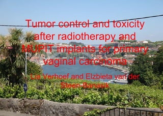 Cornelia G. Verhoef and Elzbieta van der Steen -Banasik Tumor control and toxicity after radiotherapy and MUPIT implants for primary vaginal carcinoma Lia Verhoef and Elzbieta van der Steen-Banasik 