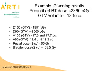 Example: Planning results Prescribed BT dose =2360 cGy GTV volume = 18.5 cc D100 (GTV) =1981 cGy D90 (GTV) = 2566 cGy V100 (GTV) =17.8 and 17.7 cc V90 (GTV)=18.4 and 18.2 cc Rectal dose (2 cc)= 65 Gy Bladder dose (2 cc) =  68.5 Gy 