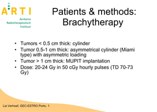 Patients & methods: Brachytherapy  Tumors < 0.5 cm thick: cylinder Tumor 0.5-1 cm thick: asymmetrical cylinder (Miami type) with asymmetric loading  Tumor > 1 cm thick: MUPIT implantation Dose: 20-24 Gy in 50 cGy hourly pulses (TD 70-73  Gy) 