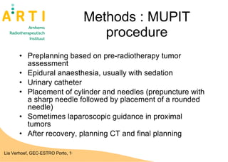 Methods : MUPIT procedure Preplanning based on pre-radiotherapy tumor assessment Epidural anaesthesia, usually with sedation Urinary catheter Placement of cylinder and needles (prepuncture with a sharp needle followed by placement of a rounded needle) Sometimes laparoscopic guidance in proximal tumors After recovery, planning CT and final planning  