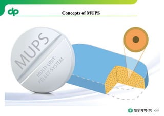 204
Concepts of MUPS
 
