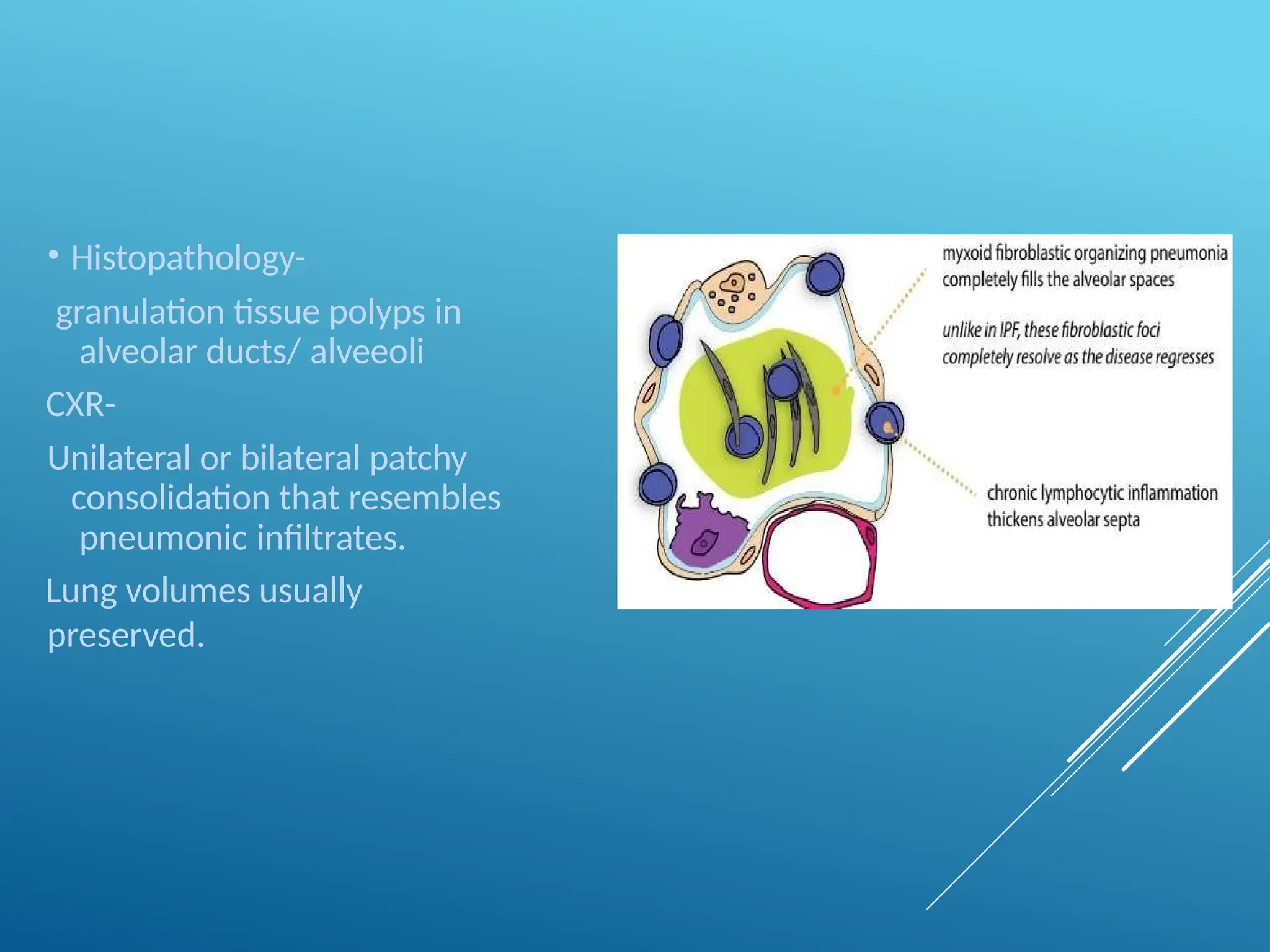 • Histopathology-
granulation tissue polyps in
alveolar ducts/ alveeoli
CXR-
Unilateral or bilateral patchy
consolidation that resembles
pneumonic infiltrates.
Lung volumes usually
preserved.
 